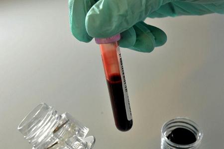 Doping bei Juniorinnen-EM: EHF ermittelt gegen russischen Verband