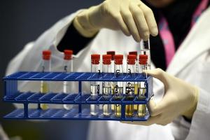 WADA hebt Suspendierung des französischen Anti-Doping-Labors auf