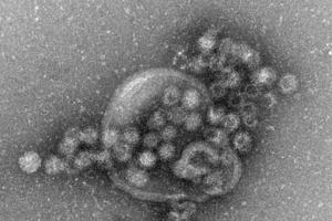 Weitere Norovirus-Fälle in Pyeongchang