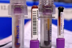 Auffällige Blutwerte: Ein Drittel aller Skilanglauf-Medaillen seit 2001 verdächtig