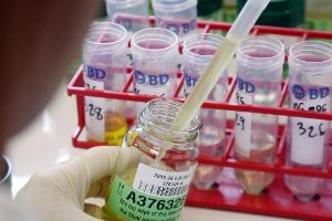 Doping-Opfer fordern finanzielle  Entschädigung vom DFB