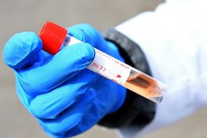 Gebauer wegen Schnelltests gegen Geisterspiele: "Unverhältnismäßig"