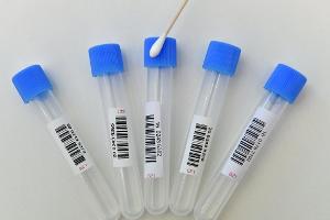 DFL: Zehn Corona-Infektionen in der 1. und 2. Liga - "Zweck erfüllt"