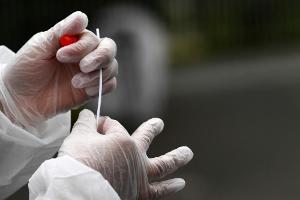 Mögliche Fan-Rückkehr: Virologe Schmidt-Chanasit fordert "Teststrategie"