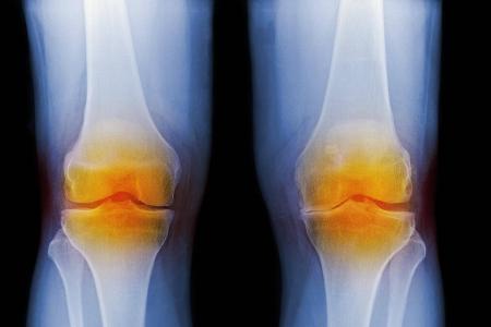 4 Verletzung_Science Photo Library.jpg