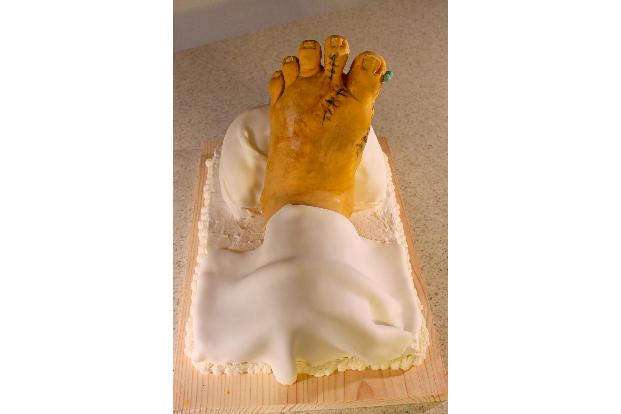 2.1 post foot surgery cake.jpg