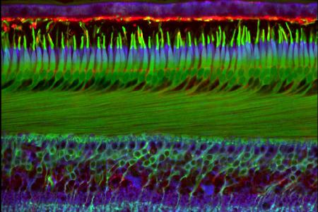 k-#20 - Human Fovea_GNB3 Cit CRALBP 40x.jpg