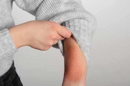 Selbst das Tragen hautfreundlicher Stoffe kann durch den Einsatz von Chemikalien zum Albtraum werden.