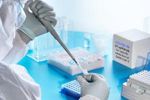 Die Coronavirus-Testkapazitäten werden weiterhin ausgebaut.