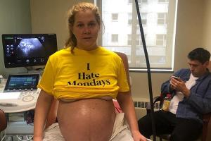 Schwangerschaftsuntersuchung bei Amy Schumer