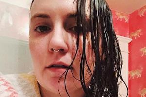 Lena Dunham spricht offen über ihre Probleme