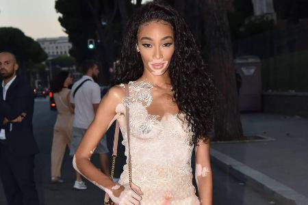 Winnie Harlow ist ein Blickfang auf der Fendi-Fashion-Show in Rom