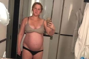 Amy Schumer erwartet ein Baby
