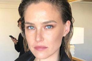 Bar Refaeli steht zu ihrem kleinen Hautproblem