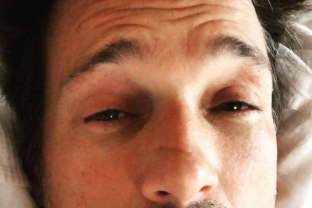 Katerstimmung bei Florian David Fitz