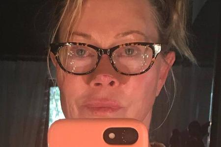 Melanie Griffith geht offen mit ihrem Krebsleiden um