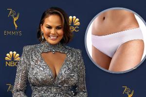 Zwei Schwangerschaften haben ihre Spuren hinterlassen: Auch Model Chrissy Teigen hat Dehnungsstreifen