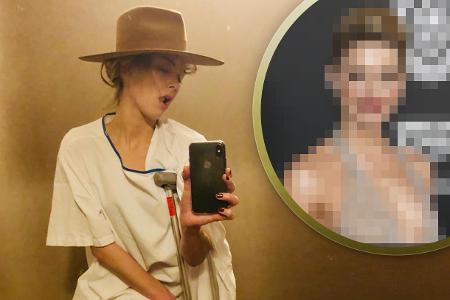 Schauspielerin Amber Heard lässt sich von einem Knochenbruch nicht die Laune vermiesen