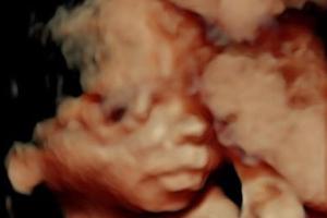 Chrissy Teigen zeigt ihr 3D-Ultraschallbild