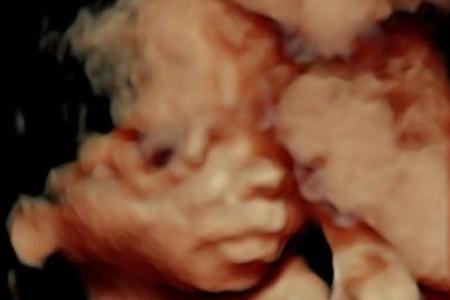 Chrissy Teigen zeigt ihr 3D-Ultraschallbild