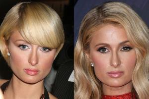 Paris Hilton im Vergleich: 2007 vs. heute (r.)