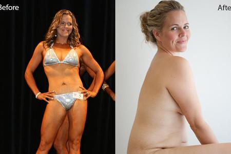 Das Vorher-Nachher-Foto von Fotografin und Doku-Regisseurin Taryn Brumfitt, das eine globale Bewegung ins Rollen brachte