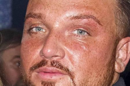 Keine leichte Zeit für Menowin Fröhlich