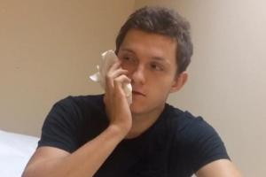 Tom Holland hat nun einen Weisheitszahn weniger