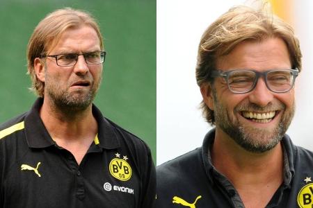 Jürgen Klopps Haaransatz sieht nach der Haartransplantation voller und gesünder aus