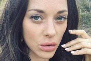 Marion Cotillard überrascht mit Schlauchbootlippen