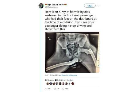 Füße auf dem Armaturenbrett Röntgenbild