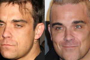 Robbie Williams 2007 (links) im Vergleich mit einer jüngeren Aufnahme