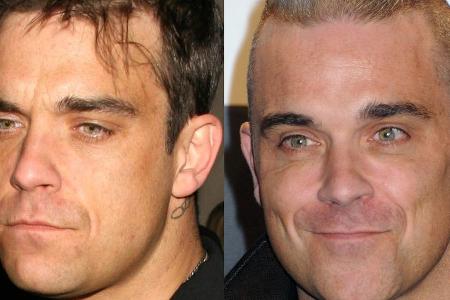 Robbie Williams 2007 (links) im Vergleich mit einer jüngeren Aufnahme