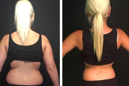 Die Speckröllchen sind weg