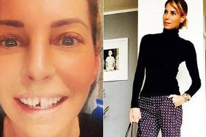 Giulia Siegel ging top gestylt zum Zahnarzt