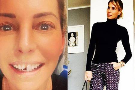 Giulia Siegel ging top gestylt zum Zahnarzt