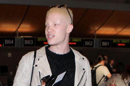 Shaun Ross gilt als erstes professionelles Albino-Model. Der New Yorker ist Afroamerikaner, doch seine Haut kann keine Farbp...