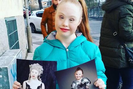 Madeline Stuart (18) aus Australien leidet am Down-Syndrom, steht aber trotzdem als professionelles Model vor der Kamera. Au...