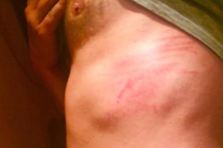 Der geschundene Körper von Carsten Spengemann