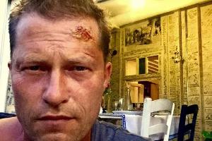 Autsch: So brutal geht es bei Til Schweigers neuem "Tatort" zu