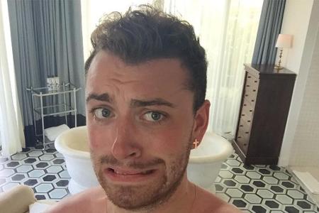 Autsch! Sam Smith zeigt seinen Followern seinen geröteten Oberkörper