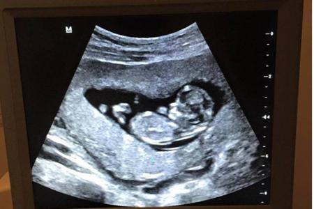 Das allererste Bild von Bublés Kind Nr. 2: Ob sich bereits eine Ähnlichkeit erkennen lässt... darüber lässt sich streiten