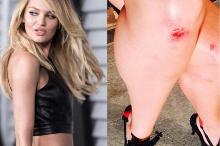 Candice Swanepoel: Kleine Kratzer nach dem Sturz auf der Fashion-Show