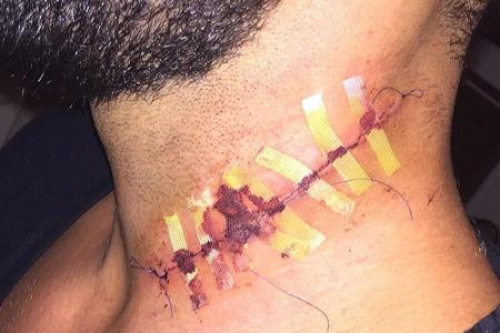 Ein Foto auf Jennifer Weists Facebook-Seite zeigt die frisch genähte Wunde ihres Begleiters