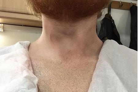 Ed Sheeran reckt seine Brust in die Kamera - ein Tattoo ist nicht zu sehen