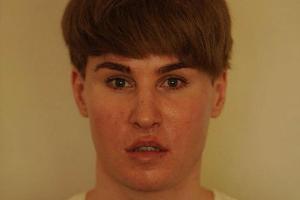 Toby Sheldon wollte so aussehen wie sein Idol Justin Bieber