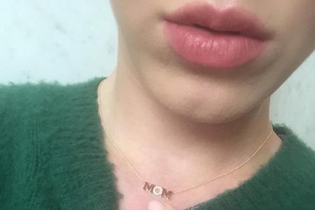 Katy Perry sorgt mit einem 