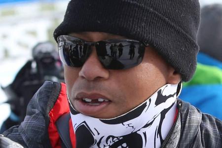 Da fehlt doch was... Tiger Woods mit Zahnlücke