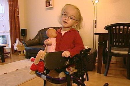 Die kleine Lea kam als siamesischer Zwilling zur Welt, am Kopf zusammengewachsen mit Schwester Tabea