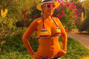 Natascha Ochsenknecht hat kein Problem mit ihren Narben